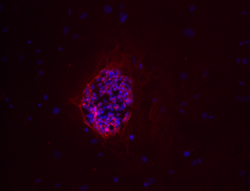 TRA-1-60 stain image of cell line BG03