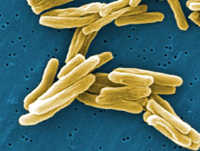 Electron micrograph of tuberculosis bacteria