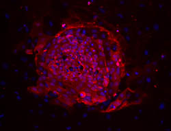 TRA-1-60-1 stain image of cell line ES01