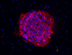 TRA-1-81 stain image of cell line ES01