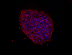 TRA-1-81 stain image of cell line WA13