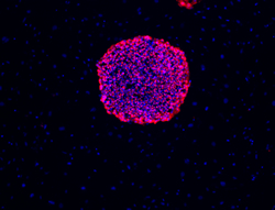 TRA-1-81 stain image of cell line BG02
