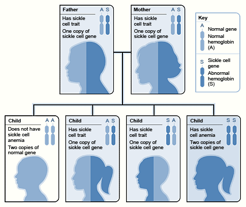 The image shows how sickle cell genes are inherited. A person inherits two copies of the hemoglobin gene—one from each parent. A normal gene will make normal hemoglobin (A). An abnormal (sickle cell) gene will make abnormal hemoglobin (S). When each parent has a normal gene and an abnormal gene, each child has: a 25 percent chance of inheriting two normal genes; a 50 percent chance of inheriting one normal gene and one abnormal gene; and a 25 percent chance of inheriting two abnormal genes.