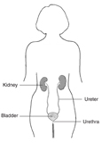Drawing of a body showing the female urinary tract with labels showing the location of the kidneys, ureters, bladder, and urethra.