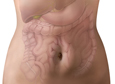 Photograph of torso with the lower portion of the lungs and the gastrointestinal tract.  The lower portions of the lungs are at the top of the drawing. The gallbladder is the small, bulb-like structure just below the right lung. The stomach is the smooth, curved organ just below the lungs. The small intestine is the smooth, winding tube in the center of the abdomen. The large intestine is the indented structure with a line running through the center. The large intestine surrounds the small intestine.