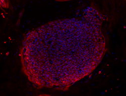 TRA-1-60 stain image of cell line WA13