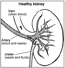 Drawing of a kidney cross section, with parts and functions labeled, showing a healthy kidney.