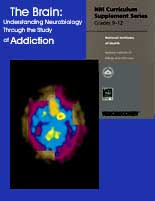 The Brain: Understanding Neurobiology Curriculum Supplement cover
