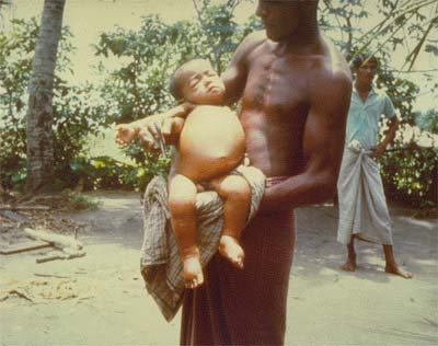 Photo of an man holding a sick child in his arms