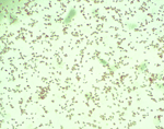 Gram stain of Granulibacter bethesdensis