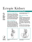 Ectopic Kidney