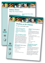 Thumbnails of the English and Spanish version of the fact sheet entitled “Kidney Stones: What You Need to Know.”