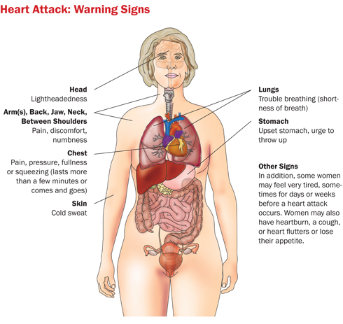 illustration of a woman's body showing how a heart attack affects the body, inside and out