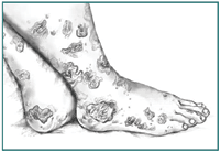 Drawing of child’s feet with multiple bruises