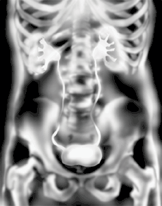 An x- ray clearly shows the structure of the kidneys as the contrast medium is filtered from the blood and passes through the kidneys and the ureters.