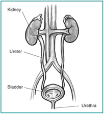Front-view diagram of a normal urinary tract with kidneys, ureters, bladder, and urethra labeled.  The bladder is shown in cross-section to reveal interior wall and openings where the ureters empty into the bladder.