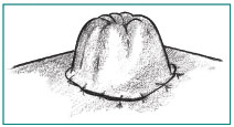 Close-up drawing of a stoma.
