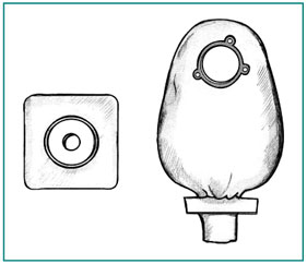 Drawing of a two-piece urostomy pouch system.  On the left is a square-shaped barrier that attaches to the skin.  The barrier has a hole in the center for the stoma.  On the right is a pouch that attaches to the barrier over the stoma so that it catches urine as it is released.
