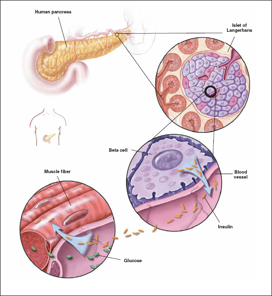 Figure 7.1. Insulin Production in the Human Pancreas. The pancreas is located in the abdomen, adjacent to the duodenum (the first portion of the small intestine), as shown in the upper left.  The upper right panel shows an enlarged cross-section of an Islet of Langerhans within the pancreas.  The Islet is an encapsulated cluster of tightly-packed cells, and contains beta cells (shown in enlargement at center), which synthesize and secrete insulin. Beta cells are located adjacent to blood vessels (shown in center and in enlargement at lower left) and can easily respond to changes in blood glucose concentration by adjusting insulin production. Insulin facilitates uptake of glucose, cells’ main fuel source, into cells of tissues such as muscle.