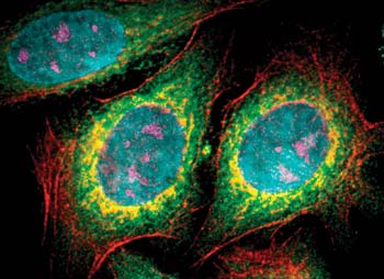 Dyes called quantum dots can simultaneously reveal the fine details of many cell structures. Here, the nucleus is blue, a specific protein within the nucleus is pink, mitochondria look yellow, microtubules are green, and actin filaments are red. Someday, the technique may be used for speedy disease diagnosis, DNA testing, or analysis of biological samples.