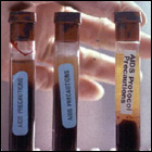 Photograph of testtubes containing potentially infected blood.