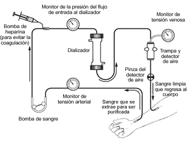 Una diagrama del circuito extracorpóreo de la hemodiálisis. Las etiquetas señalan la sangre extraída para filtración, el monitor de presión arterial, el bombeo de sangre, el bombeo de heparina para prevenir la coagulación, el dializador, el monitor de presión del flujo de entrada al dializador, el sujetador del detector de aire, el monitor de presión venosa, el purgador de aire y el detector de aire y la sangre filtrada regresando al cuerpo.