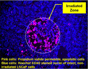 Apoptosis Induced by Light-simulated Androgen Receptor Ligand