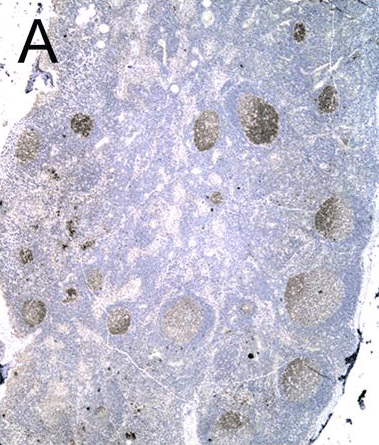 MTA3 is expressed in the B lymphocyte lineage solely in cells resident in the germinal center, mirroring the expression of the master regulator of B cell differentiation, the proto-oncogene BCL-6