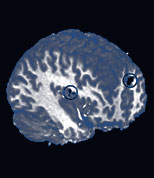 Nicotine's Double Effect on Dopamine Release