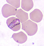 Plasmodium malariae