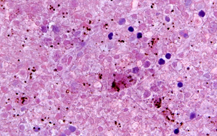 hematoxylin-eosin section of the brain