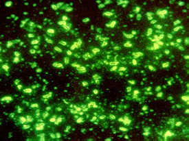 Direct fluorescence antibody (FA) staining