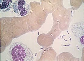 Wayson stain of Y.pestis.