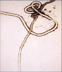 a microscopic image of ebola