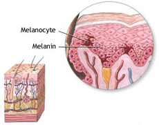 Drawing of melanin and  melanocyte.