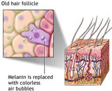 Drawing of old hair follicle.