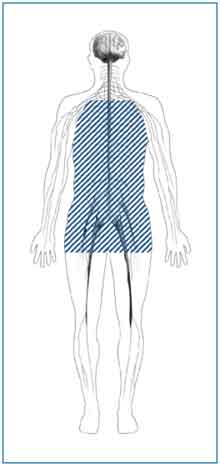 Outline of a body with shaded lines showing the location of nerves affected by autonomic neuropathy. Autonomic nerves are in the heart, stomach, intestines, bladder, sex organs, sweat glands, eyes, and lungs.