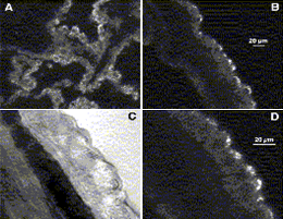 Distribution a cytoplasmic GFP construct—which is found throughout the cell and nucleus (Panel A), and of the GFP/OAT1 protein—which is expressed in the apical (CSF facing) membrane (Panels B and D)