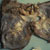 Kaposi sarcoma: diaphragm at autopsy