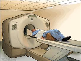 PET (positron emission tomography) scan; drawing shows patient lying on table that slides through the PET machine.