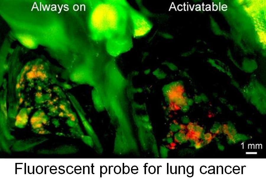 Fluorescent probe for lung cancer
