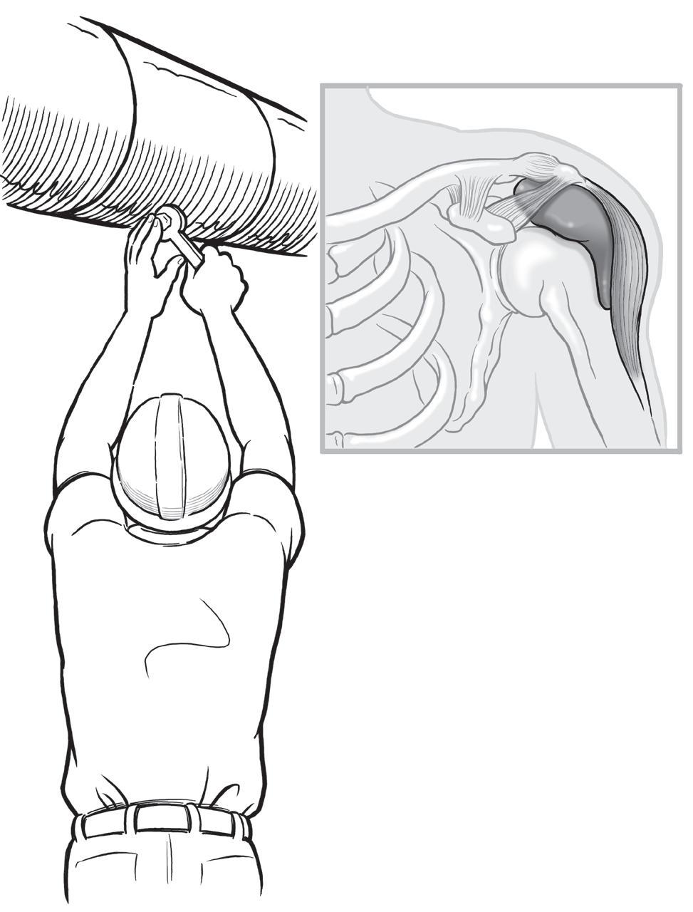 external shoulder position