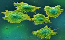 Scanning electron micrograph of 5 cells spread on a surface.