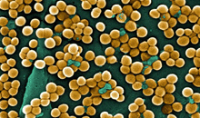 Clusters of round, golden bacteria.