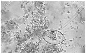Image of magnified biological agents