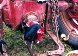 Figure 1. Clothing entangled on bolt on PTO tractor stub shaft