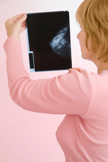 Photo of a woman looking at a mammogram X-ray.