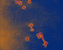 electron micrograph of Influenza A.