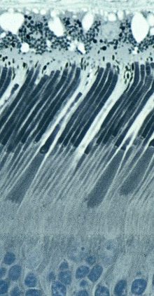 Microscopic image of rod and cone cells.
