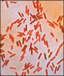 A photomicrograph of Salmonella typhosus bacteria using a Gram stain technique.